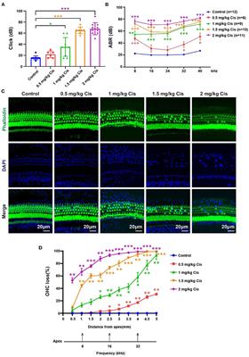 Role and mechanism of FOXG1-related epigenetic modifications in cisplatin-induced hair cell damage